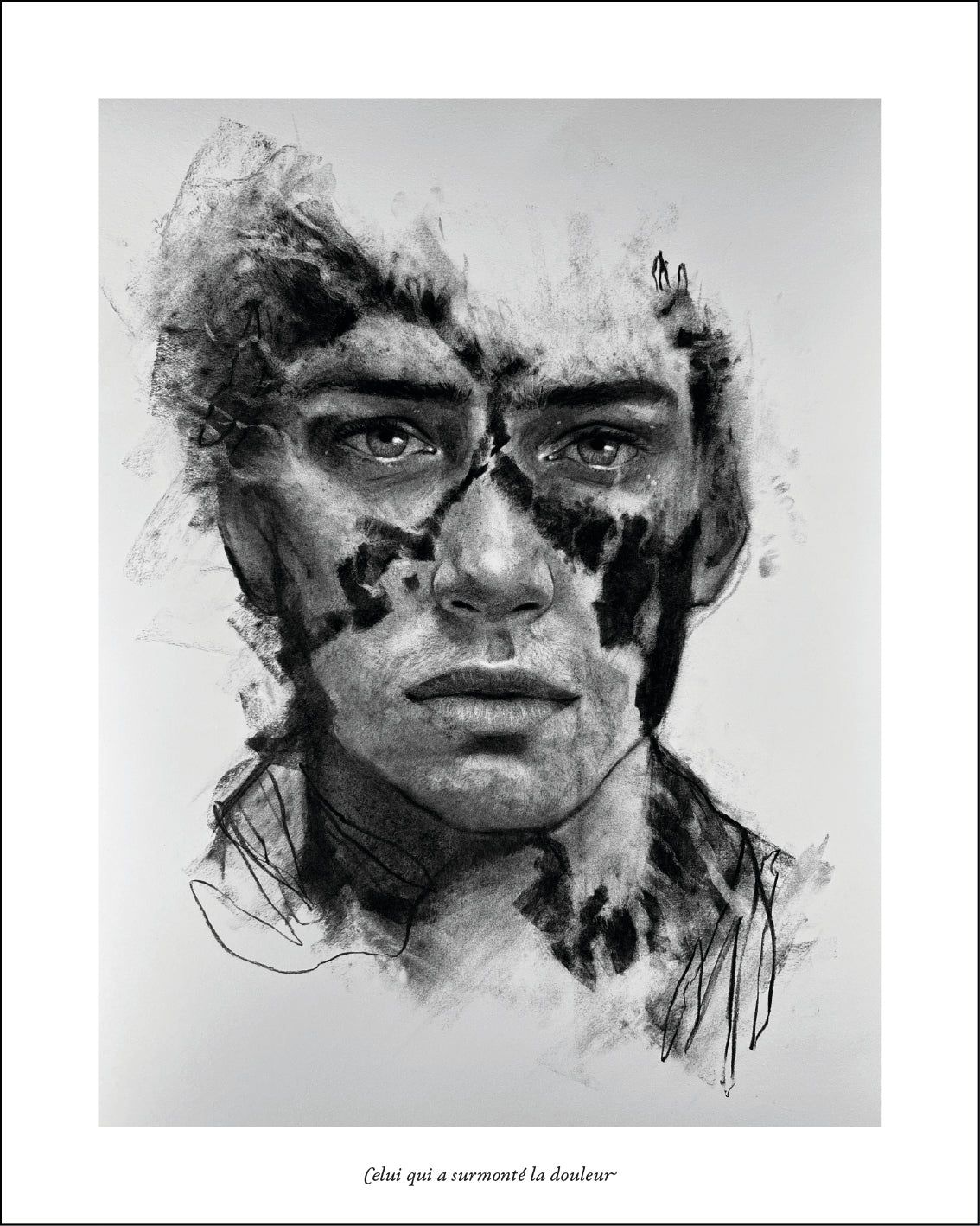 — A Man Who Overcame Pain (Limited Edition) [Private Collection]
